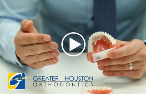 what is incognito braces office practice greater houston orthodontics invisalign specialist houston best othodontist houston tx orthodontic specialist invisalign cost adults children