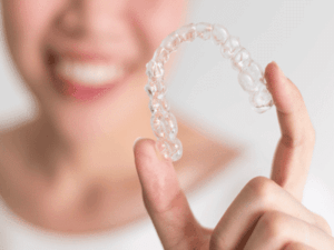 Everything You Need to Know About Invisalign | Greater Houston