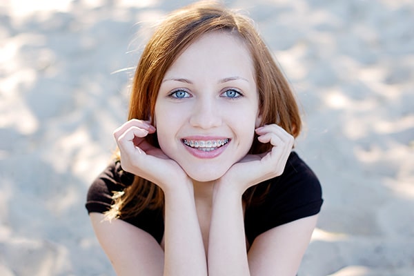 Types of Braces Greater Houston Orthodontics in Houston, TX