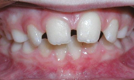 Spacing Greater Houston Orthodontics in Houston, TX